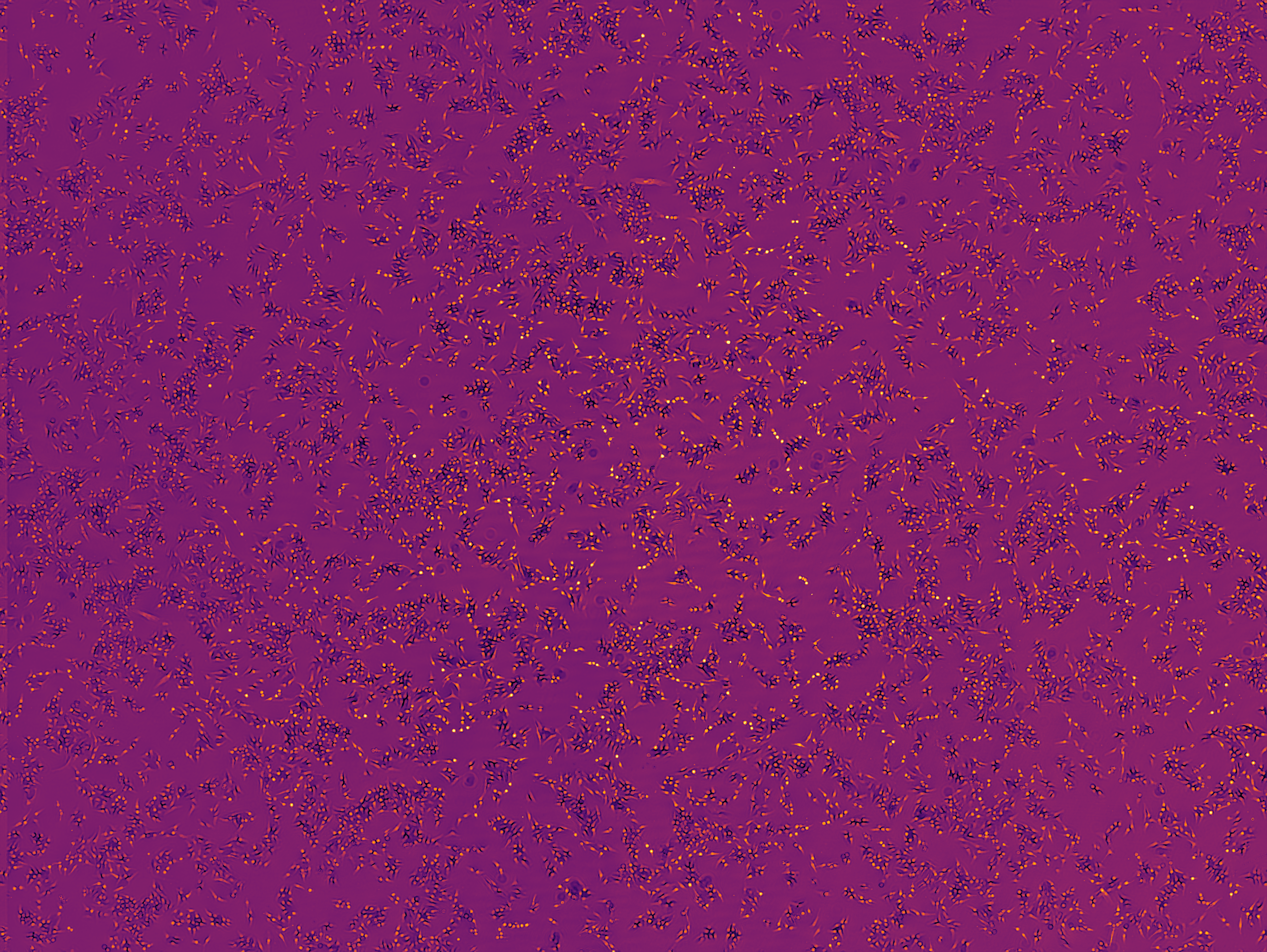 HeLa cells reconstructed via differentiable holography